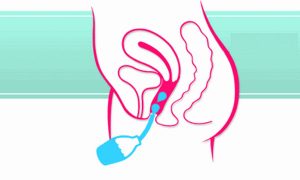 Thụt rửa âm đạo khiến vùng kín bị viêm nhiễm nặng