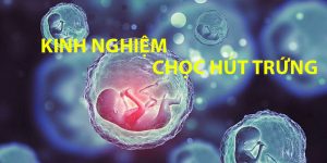 Bỏ túi kinh nghiệm trước và sau khi chọc hút trứng 4