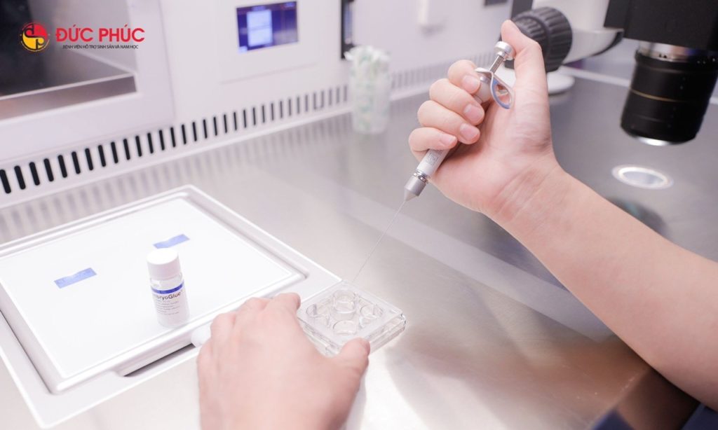 5 phút hiểu tất tần tật về keo dính phôi