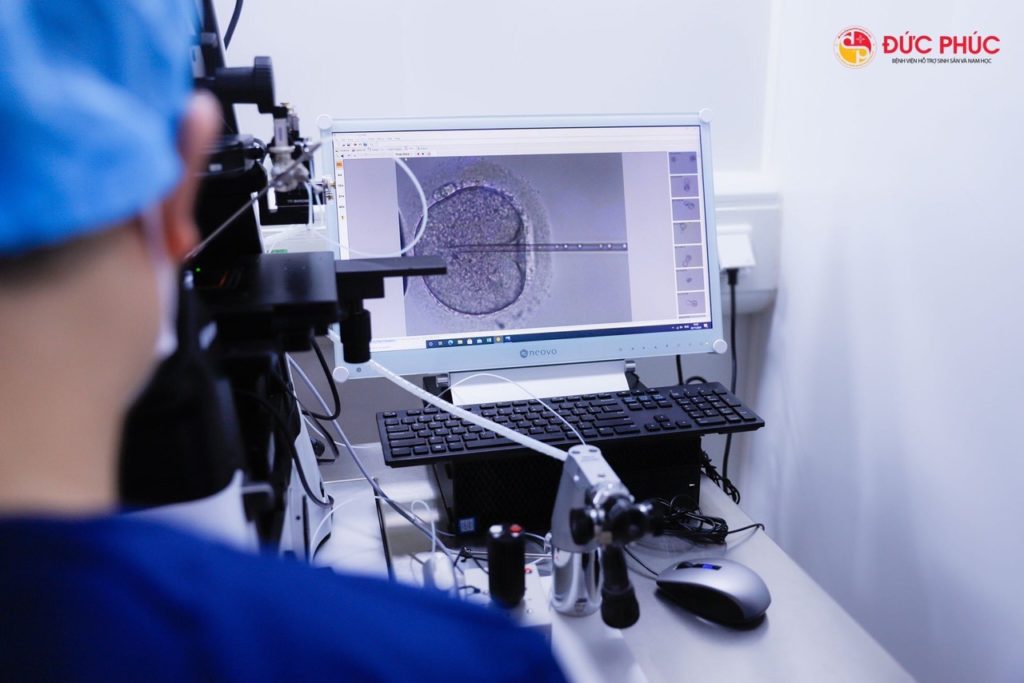 IVF/ICSI Điều kì diệu trong cuộc sống