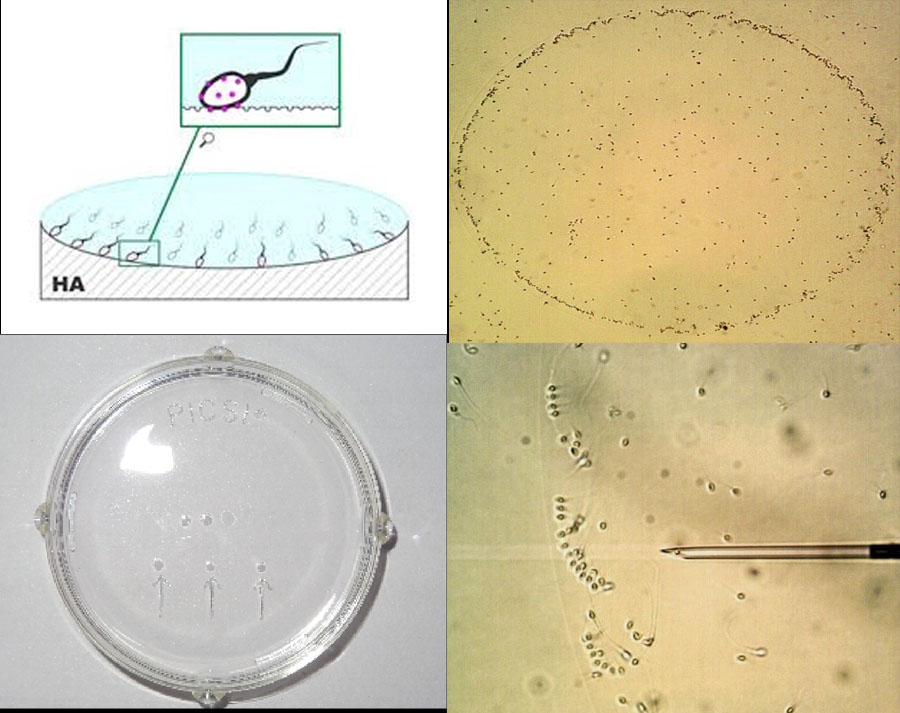 Picsi tối ưu hóa lựa chọn tinh trùng