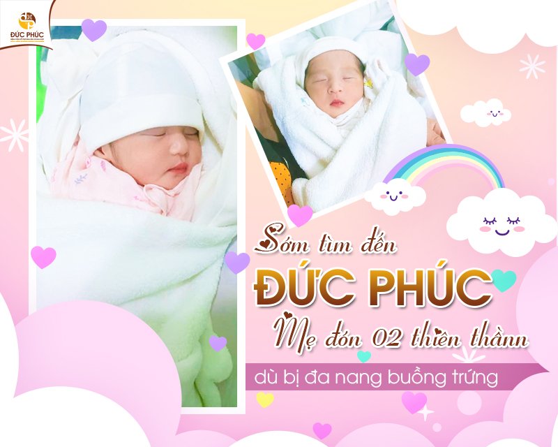 Kết quả thành công IVF tại Bệnh viện Đức Phúc là 2 thiên thần nhỏ đáng yêu