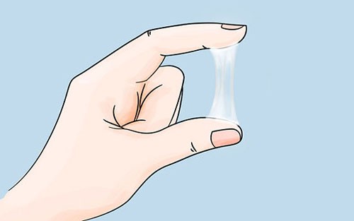Khí hư ra nhiều cũng là biểu hiện rõ ràng gây mùi hôi cho vùng kín