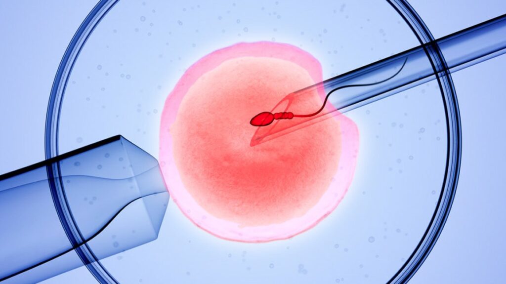 Thụ tinh trong ống nghiệm (IVF) là phương pháp mà trứng và tinh trùng gặp nhau trong điều kiện ngoài cơ thể 