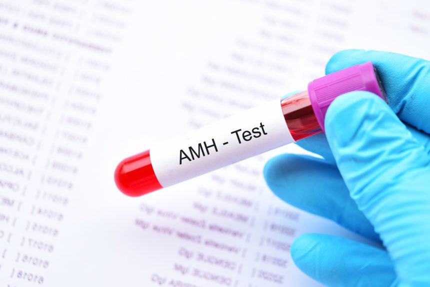 Xét nghiệm AMH có vai trò quan trọng trong việc xác định khả năng sinh sản của buồng trứng