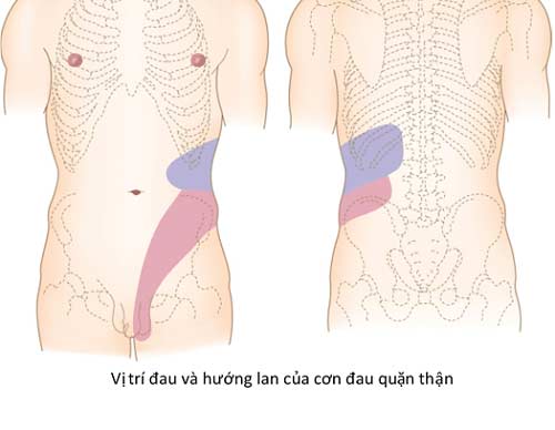 Đặc điểm về vị trí và hướng lan trong cơn đau quặn thận
