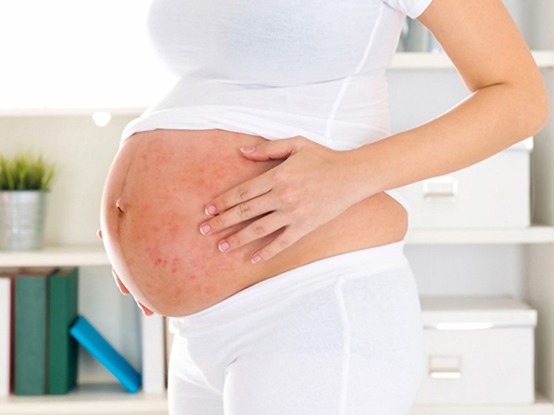 Bị ngứa do bệnh lý rất nguy hiểm, mẹ bầu không nên chủ quan