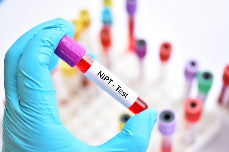 Giai đoạn 8 - 13 tuần cần thực hiện các xét nghiệm quan trọng mẹ bầu không nên bỏ qua