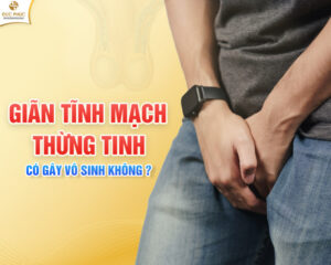 Giãn tĩnh mạch thừng tinh có thể khiến nam giới bị vô sinh hiếm muộn