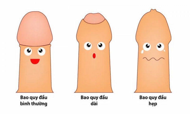 Hình ảnh bao quy đầu bình thường và bị hẹp