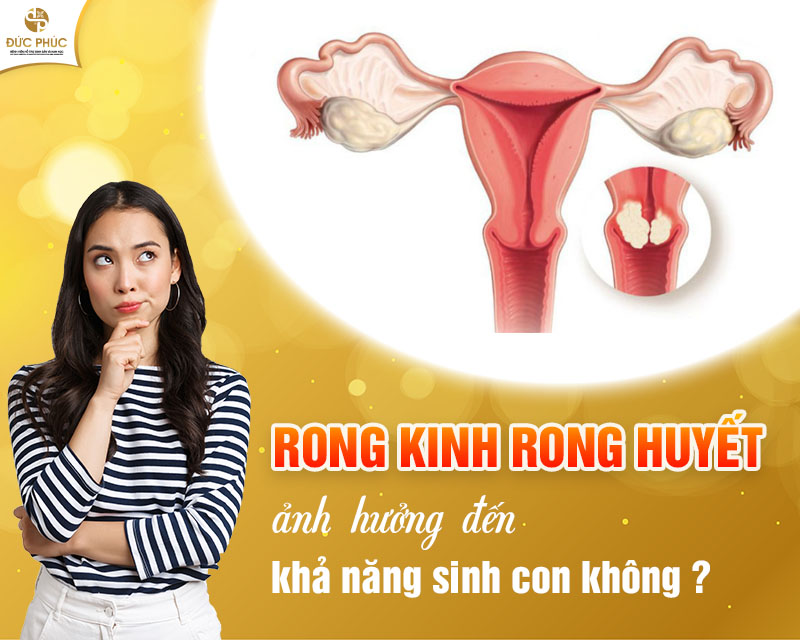 Rong kinh rong huyết ảnh hưởng không nhỏ đến sức khỏe sinh sản của chị em phụ nữ