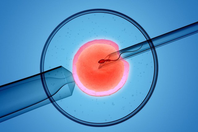khi-nao-nen-lam-ivf