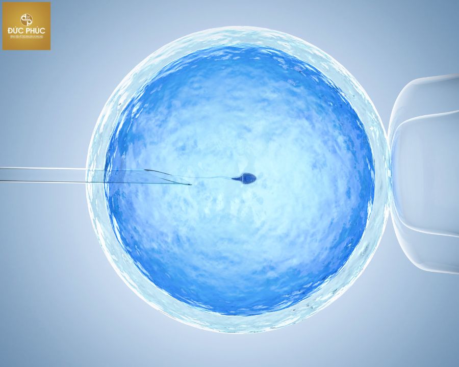Chuyển phôi là một trong những bước quan trọng nhất khi thực hiện IVF