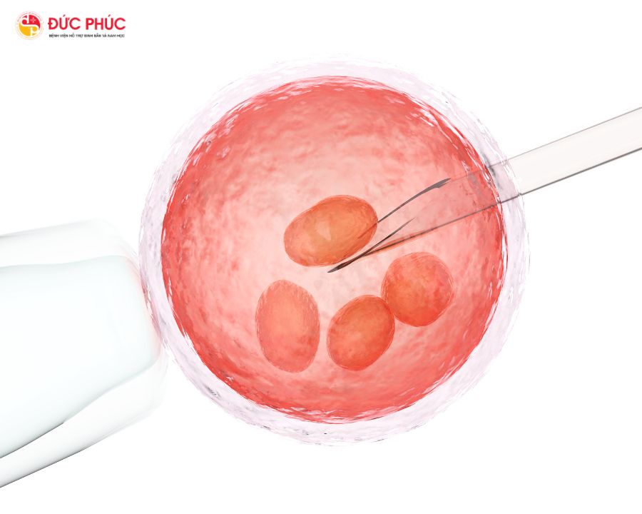 Chọc hút trứng là một trong những công đoạn quan trọng trong thụ tinh ống nghiệm