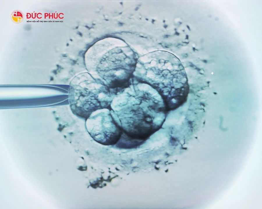 Phôi sẽ được nuôi cấy trong phòng thí nghiệm để đảm bảo điều kiện tốt nhất