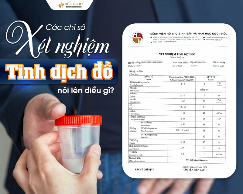 Kết quả thu được giúp đánh giá số lượng, khả năng hoạt động và hình thái của tinh trùng