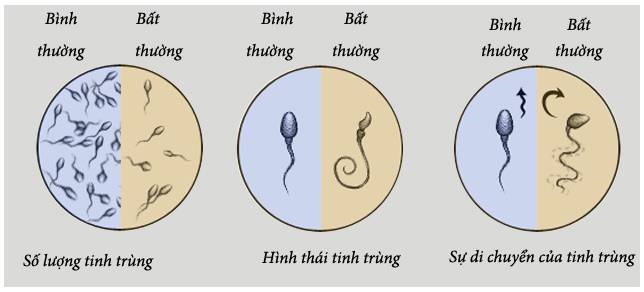 Vô sinh ở nam giới thường không biểu hiện ra ngoài một cách rõ ràng