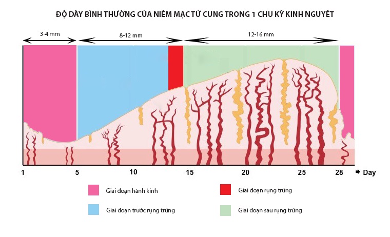 Bề dày nội mạc tử cung ≥ 8mm thì khả năng phôi làm tổ tốt hơn