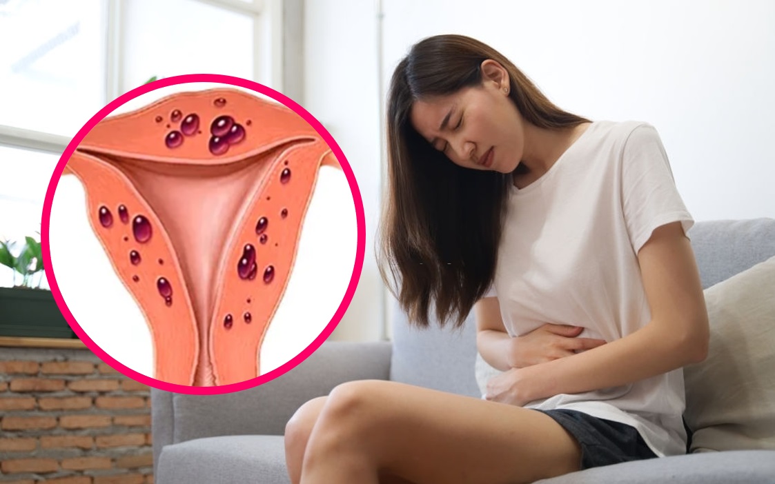 Đau bụng là một trong những triệu chứng điển hình của lạc nội mạc tử cung