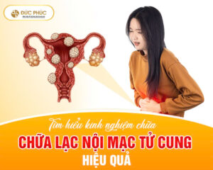 Tìm hiểu kinh nghiệm chữa lạc nội mạc tử cung hiệu quả