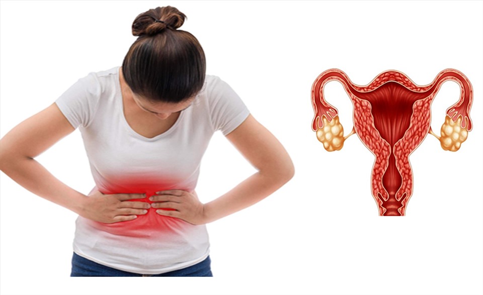 Một số bệnh lý như đa nang buồng trứng, suy thận và nhược giáp có thể làm tăng prolactin trong máu.