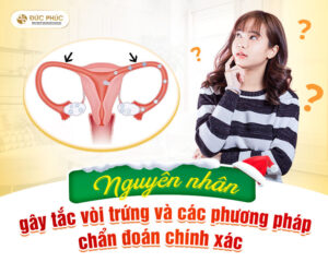 Nguyên nhân gây tắc vòi trứng và các phương pháp chẩn đoán chính xác
