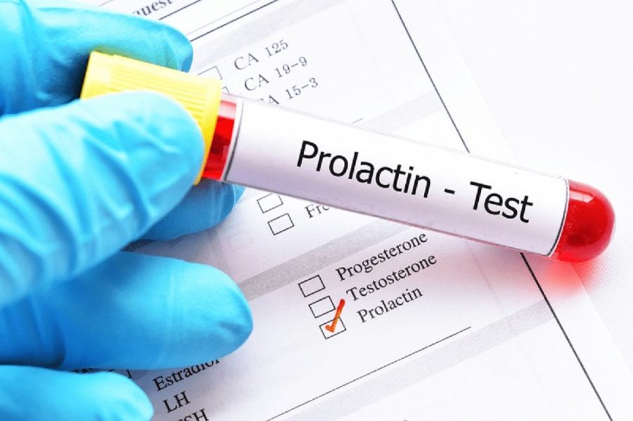 Tăng prolactin máu có thể là nguyên nhân gây vô sinh ở phụ nữ.