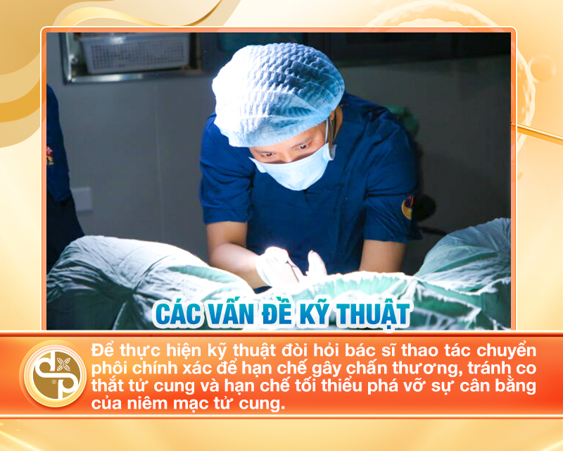 Kỹ thuật chuyển phôi cũng đóng một vai trò quan trọng trong việc quyết định sự thành công của quá trình IVF