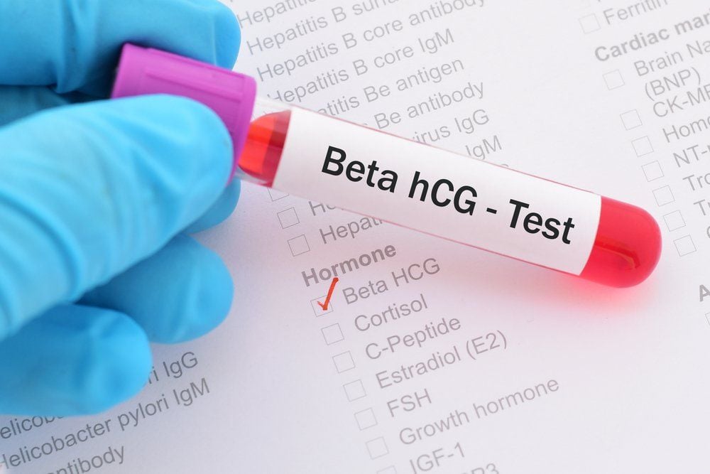 Nếu kết quả xét nghiệm beta HCG âm tính là chuyển phôi đã thất bại