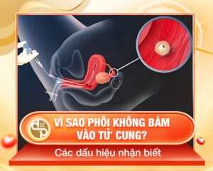 Tại sao phôi không bám sau khi chuyển phôi IVF Các dấu hiệu nhận biết