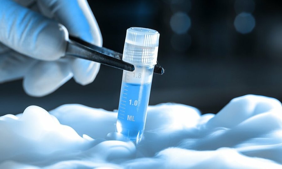 Áp dụng những kỹ thuật lấy tinh trùng phù hợp để thực hiện IVF