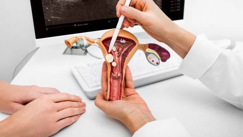Tắc vòi trứng là một trong những nguyên nhân phổ biến gây vô sinh thứ phát ở phụ nữ