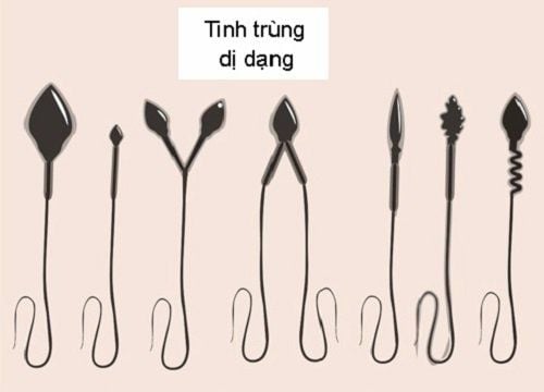 Tinh trùng dị dạng là tình trạng tinh trùng có hình thái hoặc cấu trúc bất thường