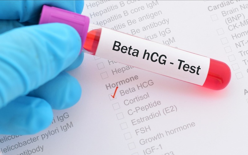 chỉ số beta hCG sau 14 ngày chuyển phôi đạt trên 25 mIU/ml được xem là chuyển phôi thành công