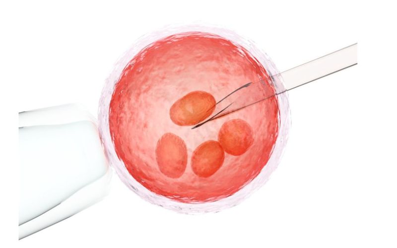 có nên thực hiện gom trứng hay không cần được bác sĩ cân nhắc kỹ lưỡng