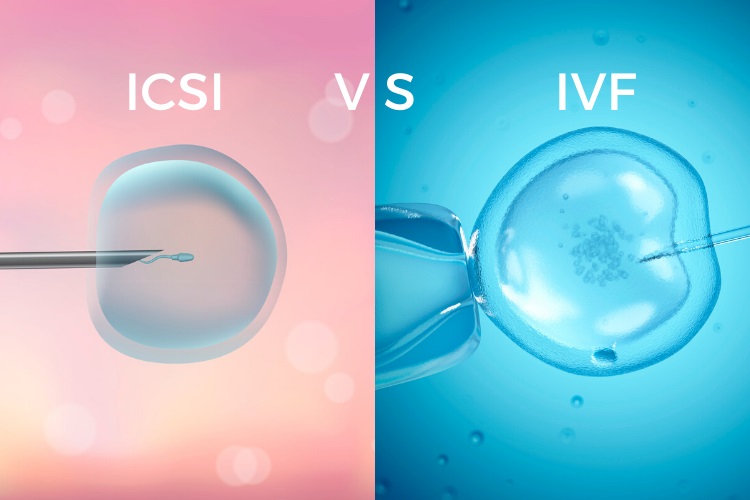 Nhờ kỹ thuật ICSI, hiệu quả IVF đối với nam giới bị tinh trùng yếu khá cao